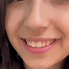 SMILEFIT PRO – SET DI DENTIERE REGOLABILI PER UN SORRISO PERFETTO