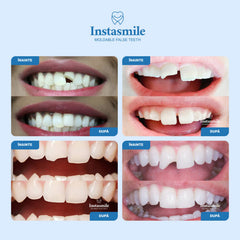 DENTIVA™ - Kit per la riparazione temporanea di denti rotti, mancanti o distanziati