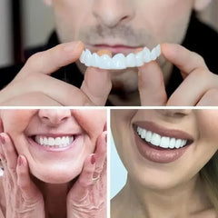 SMILEFIT PRO – SET DI DENTIERE REGOLABILI PER UN SORRISO PERFETTO