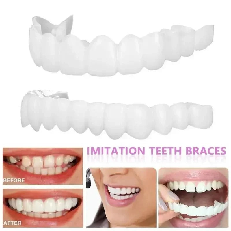 SMILEFIT PRO – SET DI DENTIERE REGOLABILI PER UN SORRISO PERFETTO